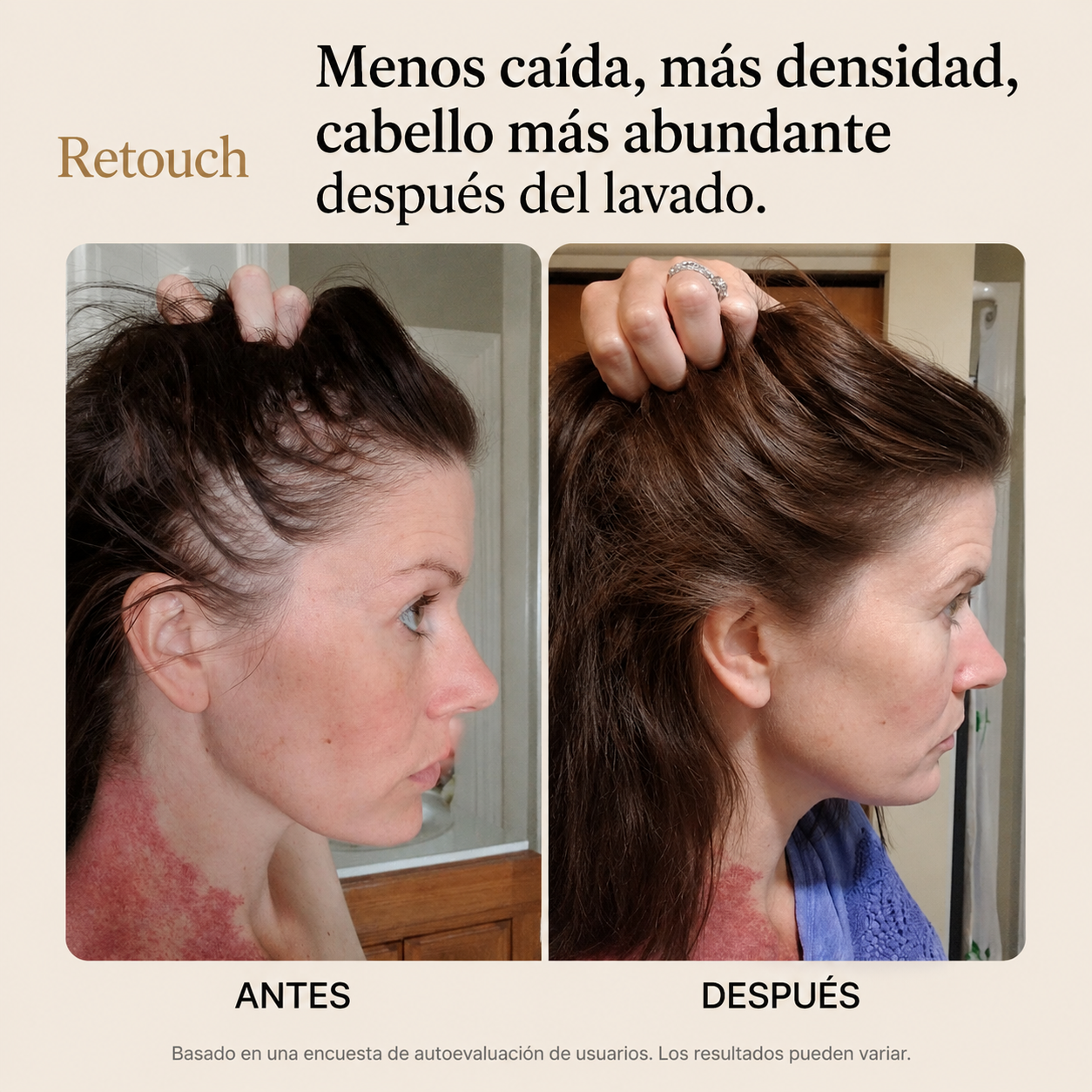 Retouch™ Barra Coreana para Crecimiento capilar y Anticaída