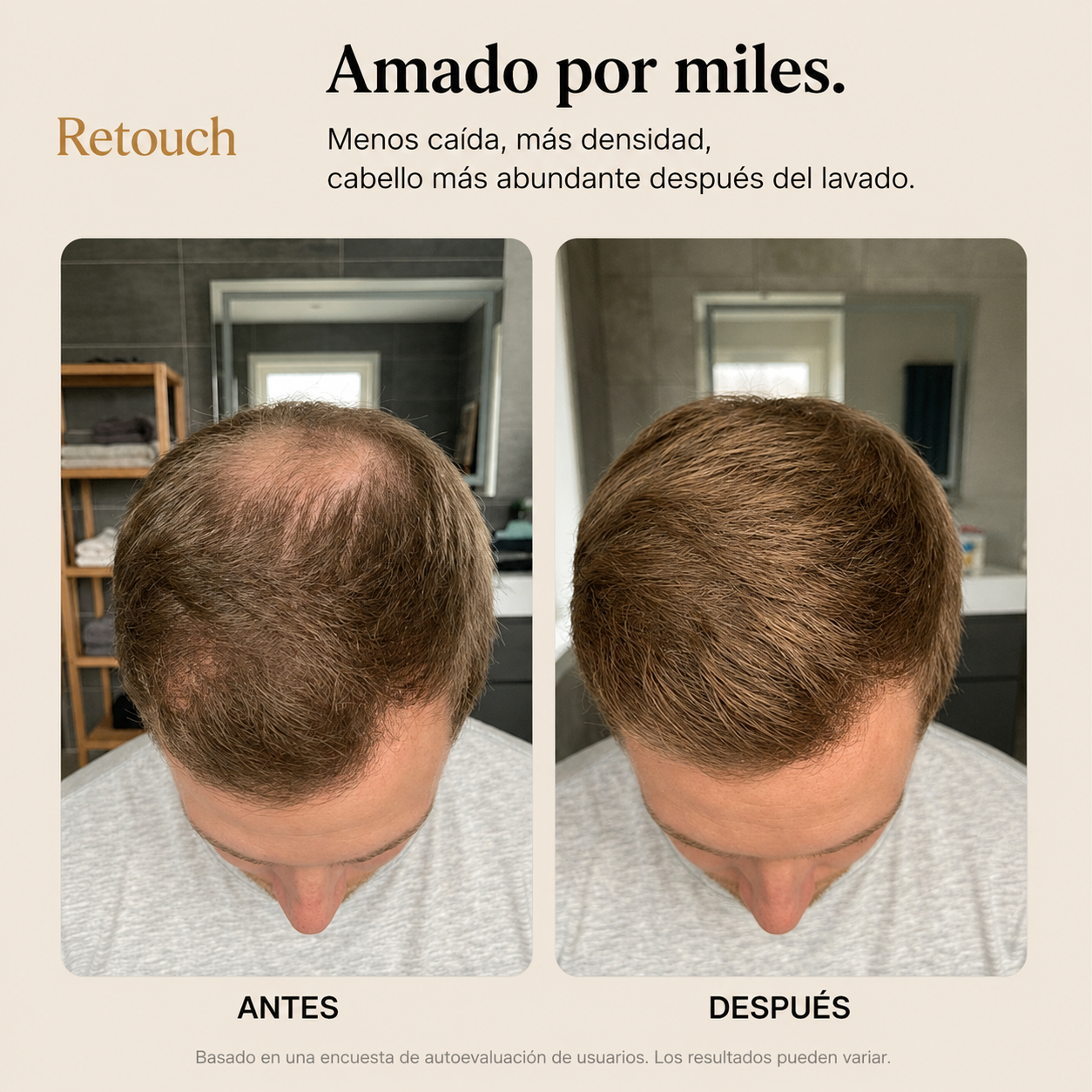 Retouch™ Barra Coreana para Crecimiento capilar y Anticaída